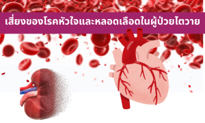เสี่ยงของโรคหัวใจและหลอดเลือดในผู้ป่วยไตวาย